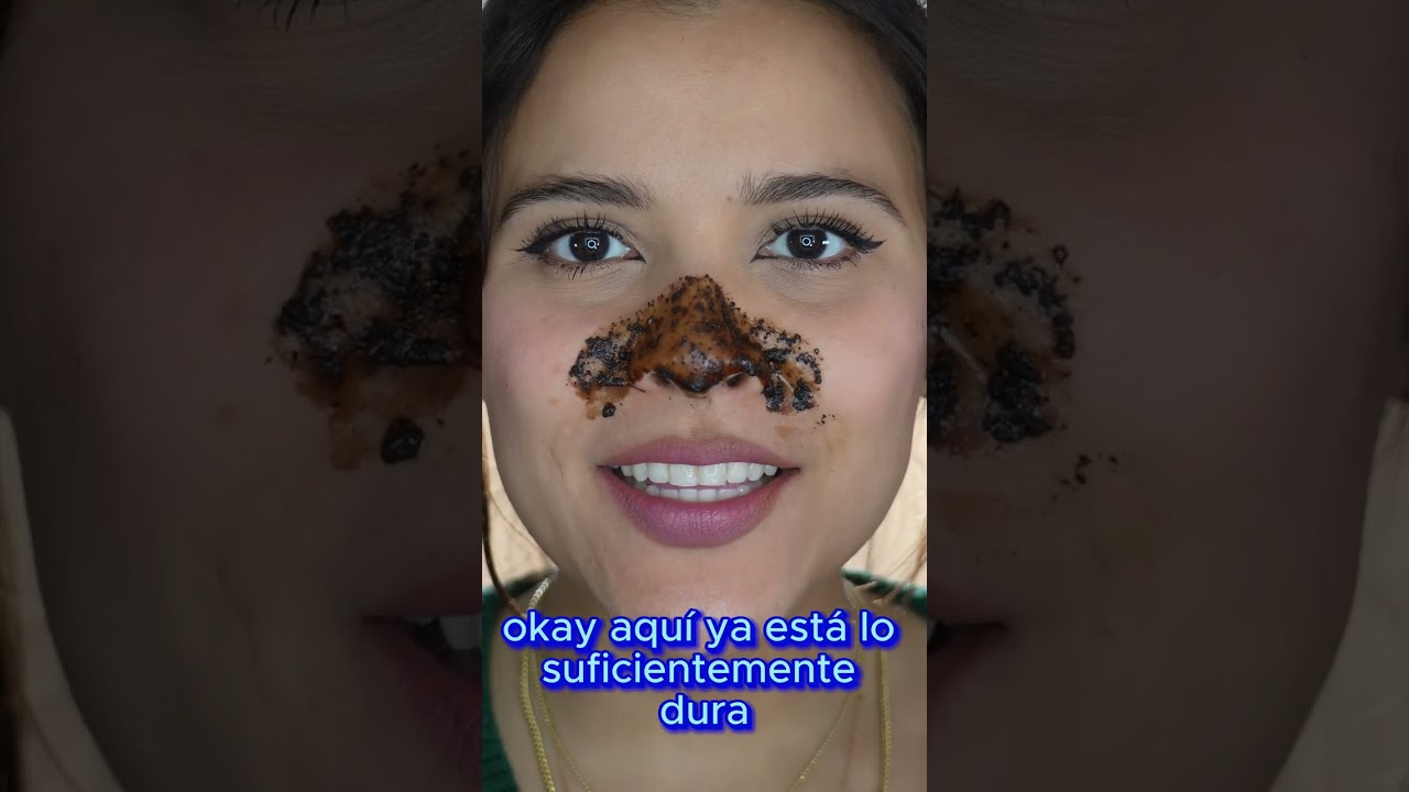 como quitar puntos negro de la cara casero