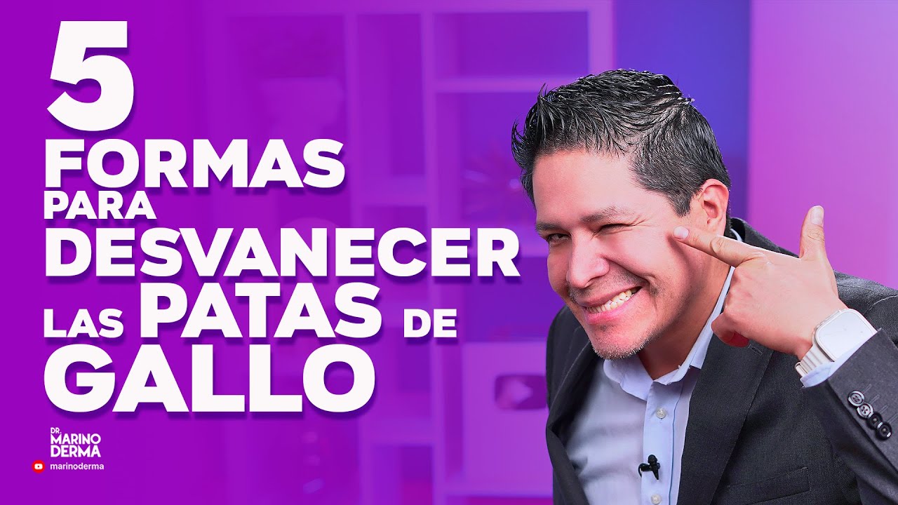 patas de gallo en la cara