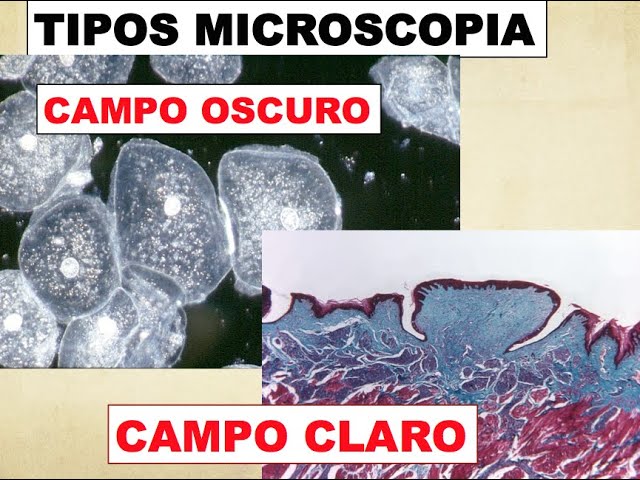 caracteristicas del microscopio de campo claro