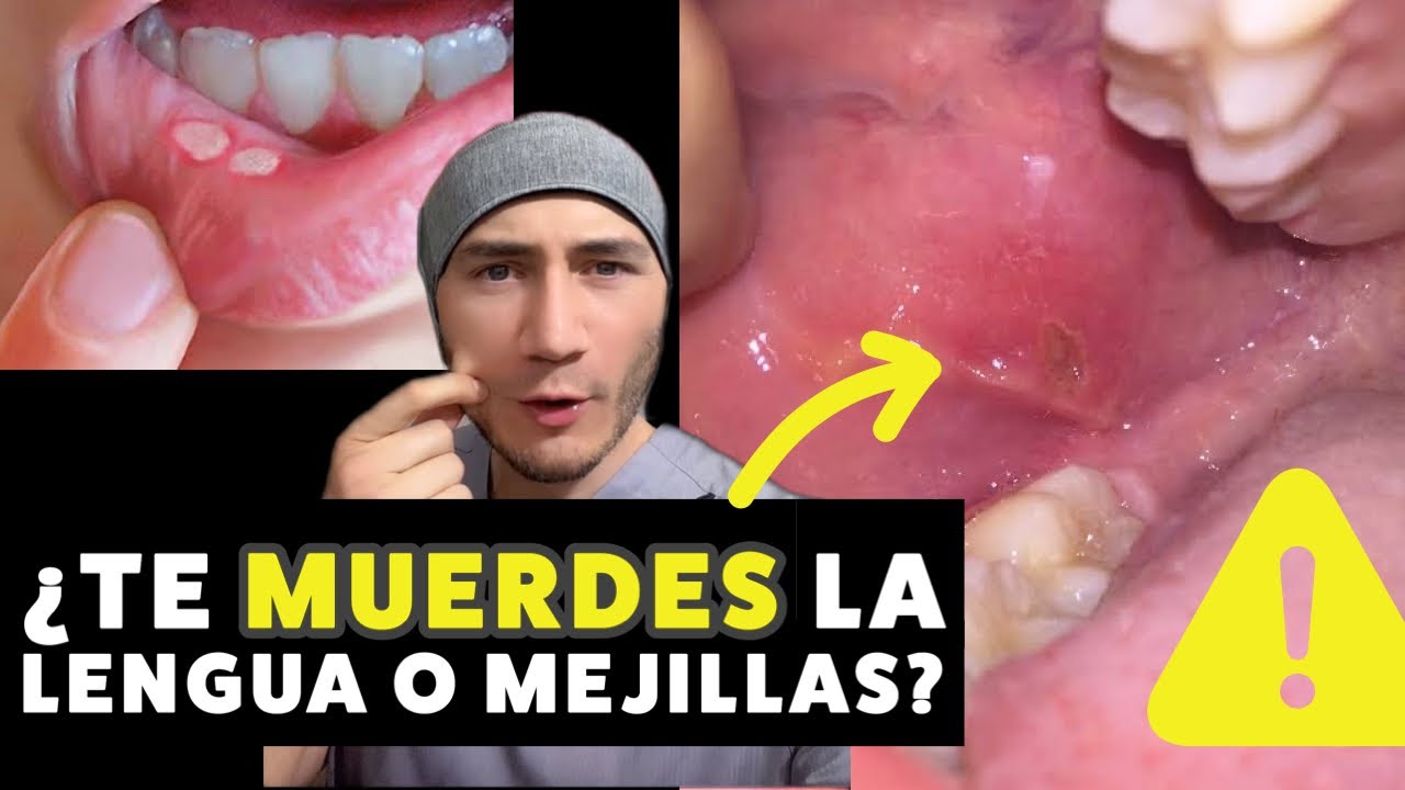 por que me muerdo los cachetes